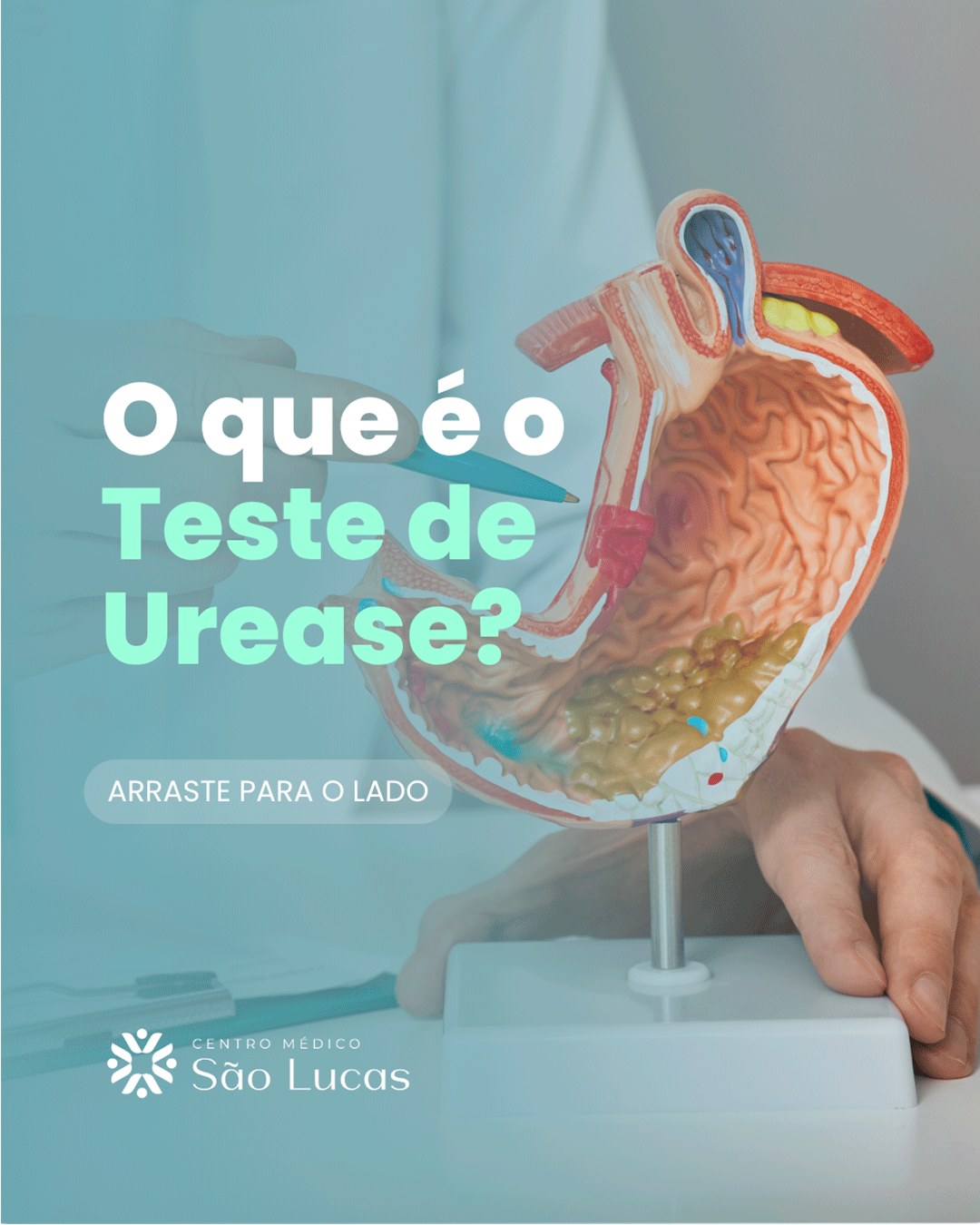 O que é o Teste de Urease?, slide 1 de 4